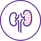 Autosomal dominant polycystic kidney disease