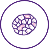 Type 1 diabetes (T1D) image