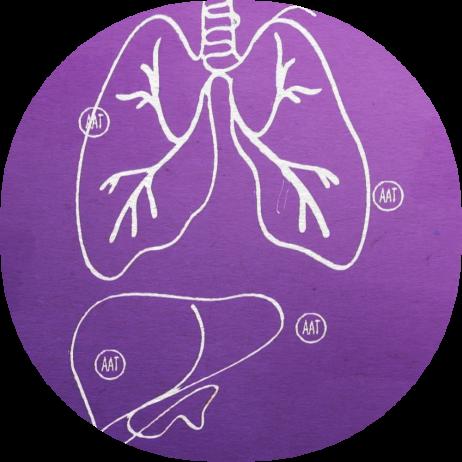 drawing of lungs from Alpha-1 Antitrypsin Deficiency animation